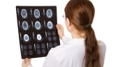 Unique Characteristics of Assault-Related Concussions