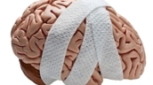 Improving Concussion Care After Violent Injury